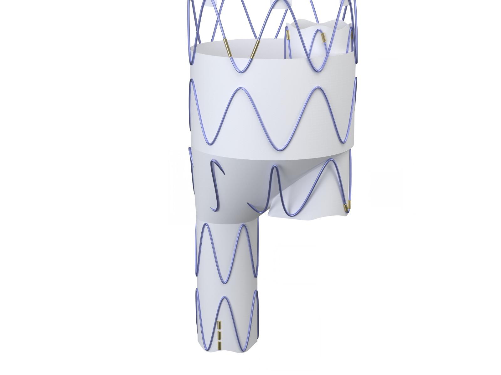 Dissection CMD - Final Configuration